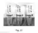 Fig. 26 - Modulation of proprotein convertase subtilisin/kexin 9 expression (PCSK9) with HSP 27 and/or HSP25