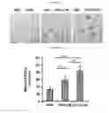 Fig. 06 - Expression of HIV inhibitors by mesenchymal stem cells