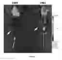 Fig. 22 - Compounds and method for imaging cancer