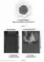 Fig. 64 - Compounds and method for imaging cancer