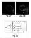 Fig. 06 - IRON OXIDE NANOPARTICLES AND THEIR SYNTHESIS BY CONTROLLED OXIDATION