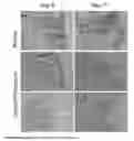 Fig. 07 - BIOCOMPATIBLE CARBOXYMETHYLCELLULOSE MATRIX (BCM) FOR HEMOSTASIS, TISSUE BARRIER, WOUND HEALING, AND COSMETOLOGY