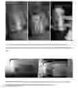 Fig. 08 - BIOCOMPATIBLE CARBOXYMETHYLCELLULOSE MATRIX (BCM) FOR HEMOSTASIS, TISSUE BARRIER, WOUND HEALING, AND COSMETOLOGY