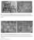 Fig. 09 - BIOCOMPATIBLE CARBOXYMETHYLCELLULOSE MATRIX (BCM) FOR HEMOSTASIS, TISSUE BARRIER, WOUND HEALING, AND COSMETOLOGY