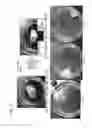 Fig. 04 - METHOD FOR ATTACHING BODY TISSUES AND KIT FOR PREPARING TISSUE ADHESIVE USED FOR THE SAME, AND DEVICE FOR TISSUE ADHESION