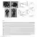 Fig. 06 - Biocompatible implants for nerve re-generation and methods of use thereof