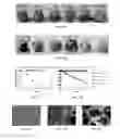 Fig. 16 - POLY(THIOKETAL URETHANE) SCAFFOLDS AND METHODS OF USE