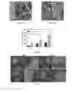 Fig. 17 - POLY(THIOKETAL URETHANE) SCAFFOLDS AND METHODS OF USE