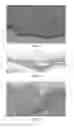 Fig. 12 - RAPID ACOUSTIC TISSUE PROCESSING METHODS, SYSTEMS, AND DEVICES