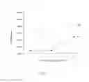 Fig. 06 - Medical needle and method of maintaining sharpness of needle