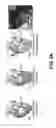 Fig. 06 - Adhesion prevention with shear-thinning polymeric hydrogels