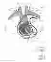 Fig. 01 - Communication methods and architecture for heart treatment systems
