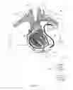Fig. 02 - Adjusting pump protocol based on irregular heart rhythm