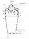 Fig. 06 - Dialysis system and method including a flow path insulator