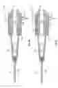 Fig. 04 - Systems and methods to detect catheter occlusion