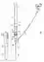 Fig. 02 - IV catheter with integral extension set and a spring powered needle safety