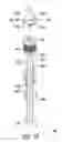 Fig. 02 - SYRINGE AND NEEDLE ASSEMBLY