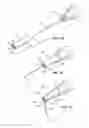 Fig. 08 - SYSTEMS AND METHODS FOR BENDING A NEEDLE