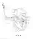 Fig. 05 - Heart Vent Catheter and Method of Use