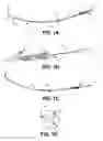 Fig. 02 - Over-The-Wire Balloon Catheter and Related Systems and Methods
