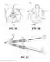Fig. 04 - Over-The-Wire Balloon Catheter and Related Systems and Methods