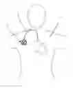 Fig. 01 - Implantable access device for accessing the vascular system of a human or animal body