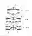 Fig. 04 - Implantable access device for accessing the vascular system of a human or animal body
