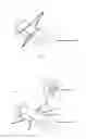 Fig. 05 - Implantable access device for accessing the vascular system of a human or animal body