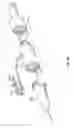 Fig. 03 - Systems and methods to prevent catheter occlusion
