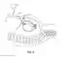 Fig. 10 - Interventional medical systems for therapy delivery in extracardiovascular spaces and associated tools and methods