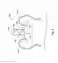 Fig. 08 - Implantable medical device with a movable electrode biased toward an extended position