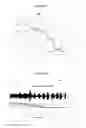 Fig. 05 - Respiratory rectification