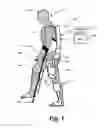 Fig. 02 - Concerted use of noninvasive neuromodulation device with exoskeleton to enable voluntary movement and greater muscle activation when stepping in a chronically paralyzed subject