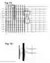 Fig. 08 - System for treating Brugada syndrome