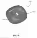Fig. 34 - Catheter-based delivery system for delivering a leadless pacemaker and employing a locking hub