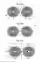 Fig. 10 - Transcutaneous energy transfer systems and methods