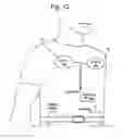 Fig. 12 - Transcutaneous energy transfer systems and methods