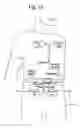 Fig. 13 - Transcutaneous energy transfer systems and methods