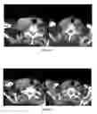 Fig. 59 - Methods of treating melanoma