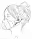 Fig. 10 - Protective respiratory mask with electronic system