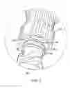 Fig. 08 - Fire-suppression water-intake valve, fire-suppression sprinkler head configured for rapid installation in, and rapid removal from, the water-intake valve without the need to interrupt the water supply, and related systems and methods