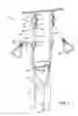 Fig. 02 - EXERCISE DEVICE FOR SUSPENDED BODY WEIGHT TRAINING