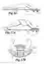 Fig. 08 - Personal exerciser/accessory