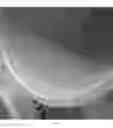 Fig. 04 - COMPETITIVE GAME AND METHOD OF PLAYING