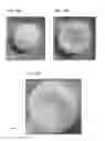 Fig. 08 - Cured biodegradable microparticles and scaffolds and methods of making and using the same