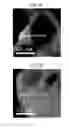 Fig. 03 - EXHAUST GAS PURIFICATION CATALYST