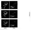 Fig. 12 - Microfluidic system for evaluation of chemotherapeutic and immunotherapeutic drugs