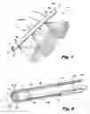 Fig. 02 - Pulsed spraybar injector