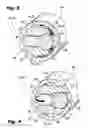 Fig. 04 - Pulsed spraybar injector