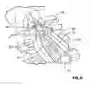 Fig. 07 - Apparatus and method for correcting damage to rails and railway crossovers